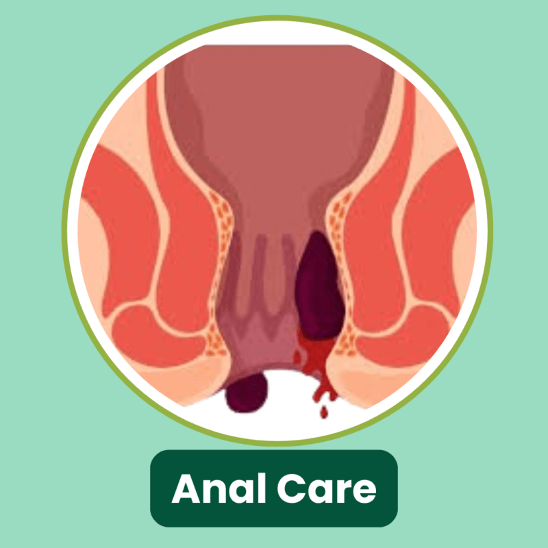 Anal Care